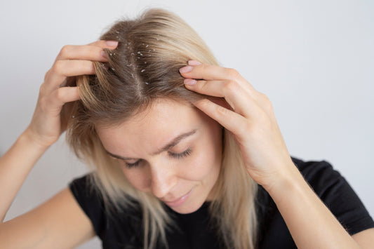 The Common Man’s Cure for Winter; Dandruff.
